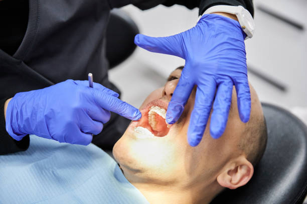 Best Emergency Tooth Extraction in Harriman, NY
