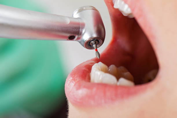 Best Pediatric Emergency Dentist in Harriman, NY